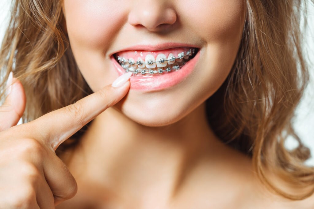 mâchoires orthodontie